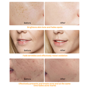 Mascarilla Facial <span class=keywords><strong>de</strong></span> Arcilla con Cúrcuma y Vitamina C <span class=keywords><strong>para</strong></span> Reducir Poros, Iluminar <span class=keywords><strong>la</strong></span> Piel Opaca, Eliminar Puntos Negros, Acné y <span class=keywords><strong>Manchas</strong></span> Oscuras - Product Image 6