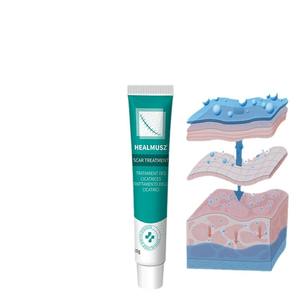 Crema Anti-Acne Rapida HEALMUSZ, <span class=keywords><strong>Trattamento</strong></span> Anti-Macchie, Crema per Rimozione Cicatrici, Riparazione Smagliature, <span class=keywords><strong>Trattamento</strong></span> Acne - Product Image 1