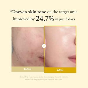 medicube Ácido Kójico e Cúrcuma Máscara Noturna Esfoliante que Ilumina e Protege Contra o Estresse da Pele para uma Pele Limpa e Radiante - Product Image 4