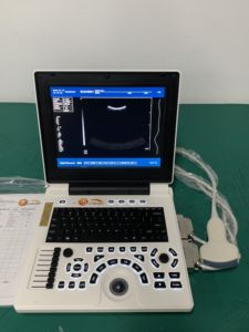 공장 가격 흑백 초음파 진단 스캔 기계 수의학 진단 장비 - Product Image 2