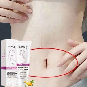 妊娠纹霜工厂 OEM ODM 芒果身体产后恢复去除 - Product Image 5