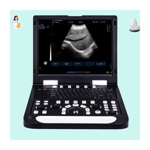 Máquina de escáner de ultrasonido digital portátil Sistema de diagnóstico ultrasónico para mujeres <span class=keywords><strong>embarazadas</strong></span> y perros Ser humano - Product Image 1