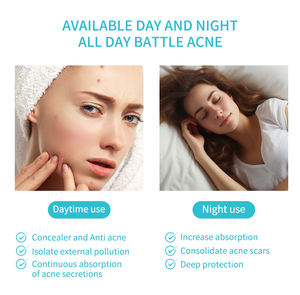 36개 패치/시트 별 모양 컬러 여드름 패치 메이크업 하트 모양 커버 도매 컬러 별 여드름 패치 - Product Image 4