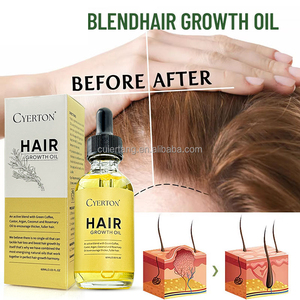 Benutzer definierte pflegende Biotin Natural Herbal Organic Regrowth Rosmarin öl für Haarwuchs produkte Private Label Repair Treatment - Product Image 2