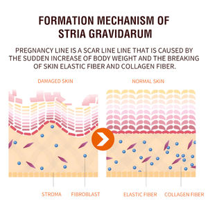 <span class=keywords><strong>Meilleure</strong></span> crème efficace au collagène pour les vergetures crème pour enlever les cicatrices crème nourrissante pour le traitement intensif des vergetures crème pour les femmes - Product Image 2