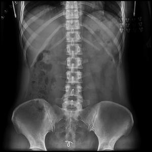 用于<span class=keywords><strong>DR</strong></span>的17*17英寸数字无线x射线平板探测器 - Product Image 5