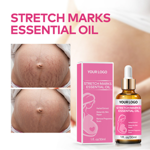 Huile de jojoba pour le soin de la peau et le massage corporel, <span class=keywords><strong>anti</strong></span>-vergetures, huile essentielle pour éliminer les vergetures - Product Image 4