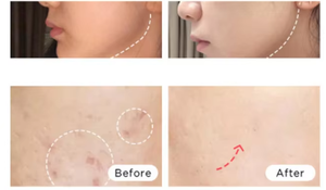 Máquina de Láser CO2 Fraccional Profesional de 60W para Eliminación de Cicatrices, Cuidado de la Piel, Láser de Belleza, Grabador Láser Fraccional - Product Image 6