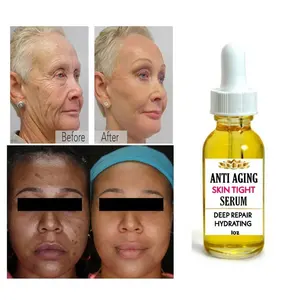 Kunden spezifisches Logo Best Anti Aging Serum Lifting Straffende Falten Entferner Gesichts serum für Dark Spot Corrector