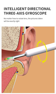 NE3-C Pro Dispositivo per la Pulizia delle Orecchie, Elettrodomestico per la Cura Personale, Visibile e con Ricarica Type-C, Connessione Wi-Fi e Base - Product Image 5