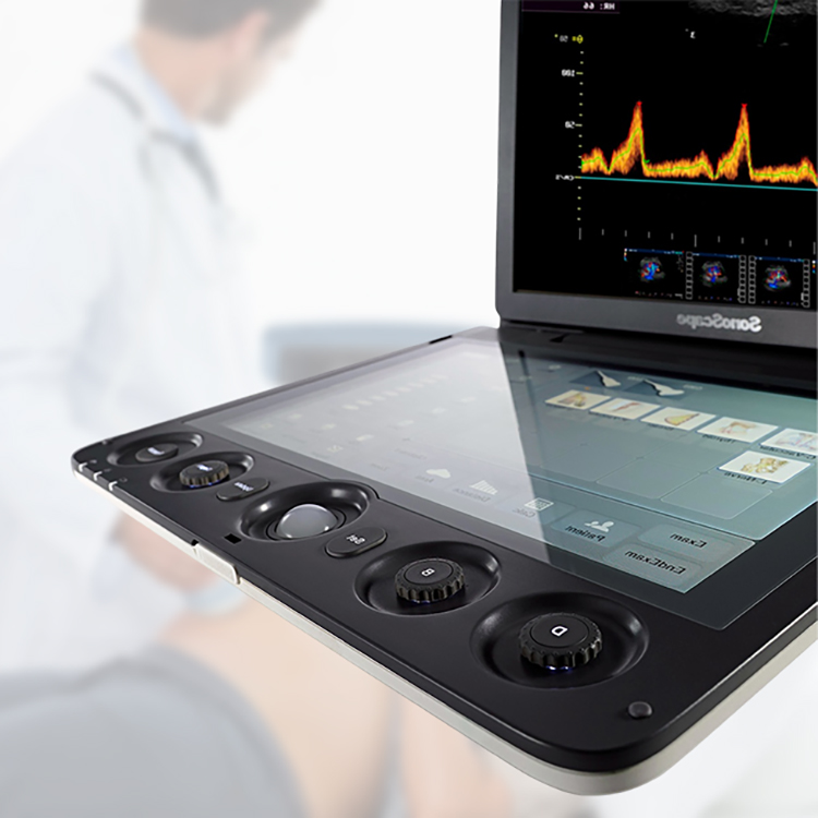 Máquina de ultrasonido de alta resolución Sonoscape S9 Sistema de ultrasonido Doppler en color con sonda
