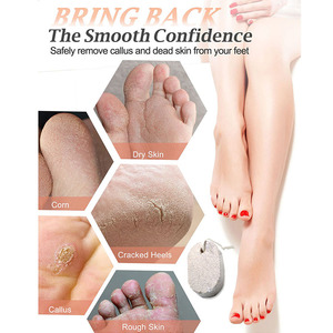 Hot Selling Natural Pumice Stone Pedicure Tools <strong>Remover</strong> for Feet and <strong>Hands</strong> Exfoliation to Remove Dead Skin - Product Image 2