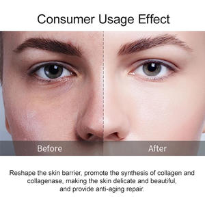 Private Label Custom Retinol Peptide <b>Serum</b> Centella Asiatica Soothing Anti Aging Firming Bulk Brightening For Mature Skin - Product Image 6