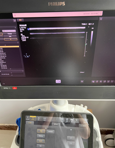 Sonda de ultrasonido de matriz lineal intraoperatoria de 220V, electrónica, a la venta, a la venta - Product Image 2