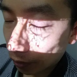 Dispositivo buscador de vasos sanguíneos infrarrojos buscador de venas faciales portátil médico - Product Image 1