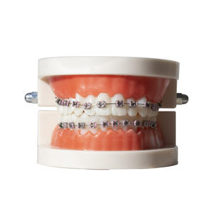 Allineatori Dentali DM Apparecchi Ortodontici Colorati e alla Moda Staffe per Denti Decorazioni Dentali per Adulti e Adolescenti - Product Image 1