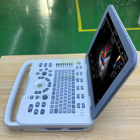 Promotion : Sonographe Doppler Portable pour Animaux – Échographe USG pour Bétail et Animaux de Compagnie avec Sonde d'Examen