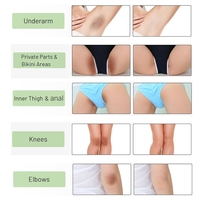 Label privé Crème correctrice intime pour les taches brunes Coudes Genoux Zones du bikini Même les tons de peau Crème blanchissante éclaircissante