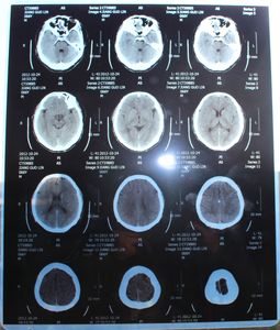 Pellicola Radiografica Termica Blu Personalizzata per Imaging a Secco, Base Blu per Toner <span class=keywords><strong>Laser</strong></span> Medico - Product Image 6