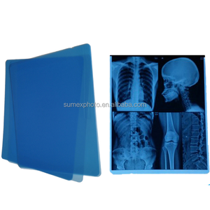 M R.R Venta directa de fábrica 8x10 <span class=keywords><strong>14x17</strong></span> pulgadas Impresión de inyección de tinta Película médica azul para radiología <span class=keywords><strong>X</strong></span> <span class=keywords><strong>Ray</strong></span> CT MRI MR - Product Image 3