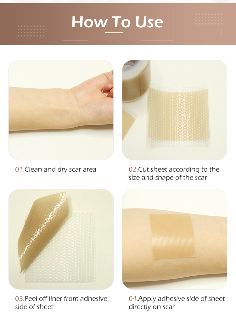 Новый продукт, пластырь для удаления шрамов, растяжка, ожоги, работа, снижение шрамов, силиконовые шрамы