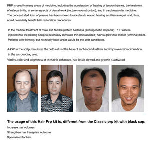 Saç tamir için MANSON tıbbi kaynağı tek kullanımlık vakumlu kan toplama tüp <span class=keywords><strong>PRP</strong></span> tüp - Product Image 5