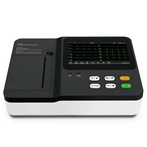 Hayvan Klinikleri için Yüksek Çözünürlüklü 3 Kanallı Taşınabilir Veteriner EKG Monitörü - Product Image 4