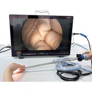 Sistema de videoendoscopia de alta definición, monitor de sistema de Endoscopia <span class=keywords><strong>Gastrointestinal</strong></span> superior con sistema de cámara para endoscopia veterinaria - Product Image 1