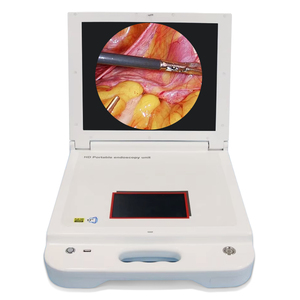 Caméra d'endoscopie en gros 1080p <span class=keywords><strong>HD</strong></span> médicale portable Hystéroscope Caméra endoscopique Fabricant - Product Image 6