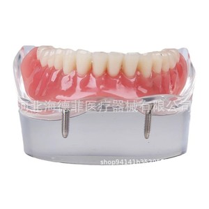 Modèle d'implant dentaire maxillaire et mandibulaire à 2 ou 4 vis en silicone médical pour la formation dentaire - Product Image 2