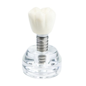 Modelo Dental Transparente para Comunicación Manual entre Médico y Paciente, Implante de Cristal, Accesorios para Terapia Oral, Certificado CE - Product Image 4