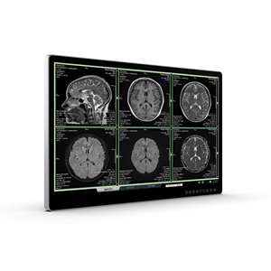 Sản phẩm mới 31.5 "4K Y Tế cấp màn hình cho phẫu thuật hiển thị - Product Image 4