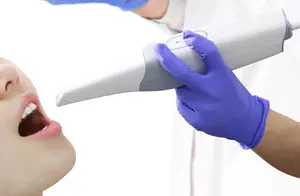 New Arrival Scanner Dental Intraoral 3d Scanner Ce USB 3.0 Hand Piece Dental Dental Clinic CE Approved Lacer Pour Metal Dental
