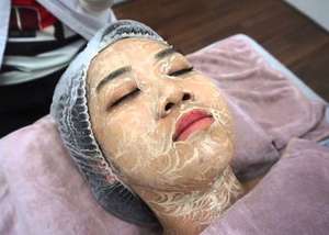 Meso Glow-suero de mesoterapia semipermanente, para salón de belleza, SPA, base de mesoterapia - Product Image 3