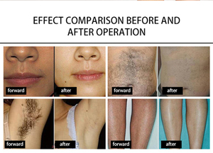 จัดส่งฟรี เครื่องวิเคราะห์ผิว 3 มิติ AI ระดับมืออาชีพ เครื่องสแกนใบหน้าและหนังศีรษะ สำหรับคลินิก ความละเอียดสูง ตรวจสอบความชื้นด้วยแสง UV อัจฉริยะ - Product Image 5