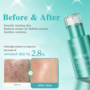 Sérum ZS OEM Aze Acid Exoso Spicule Shot 7500 Hydratation intense pour un teint lisse et uniforme après les soins anti-taches avec de la niacinamide coréenne - Product Image 5
