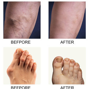 Perfectx Counterpain Crema Corpo per Dolori Articolari, Ossei, Ginocchio Valgo e Muscolari, Unguento da 50g, Crema al Collagene per Massaggio di 15 Minuti - Product Image 5