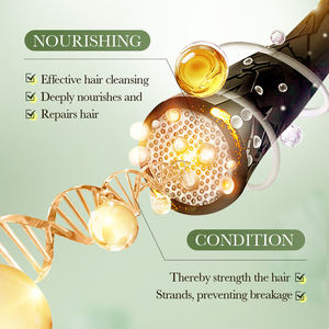 Shampooing nourrissant anti-alopécie de marque privée SADOER Ginseng Radix Polygoni Multiflori pour soulager les <span class=keywords><strong>démangeaisons</strong></span> et les <span class=keywords><strong>pellicules</strong></span> - Product Image 4