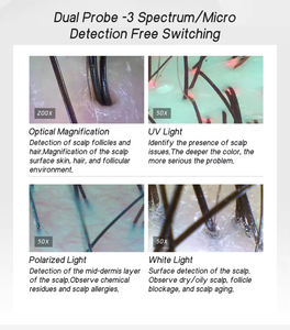 Prueba de Análisis Capilar y del Cuero Cabelludo de 3 Espectros, Microcámara Portátil para Análisis Capilar y Tratamiento del Cuero Cabelludo - Product Image 4