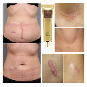 Shoppe vendita calda <span class=keywords><strong>LBN</strong></span> rimuovere crema cicatriziale riparazione crema cicatriziale riparazione rapida crema cicatriziale - Product Image 5