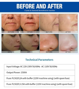 Système professionnel de soin de la peau, pression et flux réglables, écran LCD, élimination des points noirs, rajeunissement de la peau, machine de beauté pour salon - Product Image 6