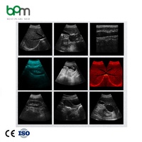 Alat USG Hewan Portabel Warna Doppler 3D/4D Instrumen Medis Layar 12 Inci Arsitektur Chip ARM Bersertifikasi CE untuk
