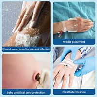 Pansement de fixation de canule IV pour usage hospitalier/clinique, film PU transparent, certifié CE, stérilisé à l'oxygène, pansement pour plaies, ruban chirurgical