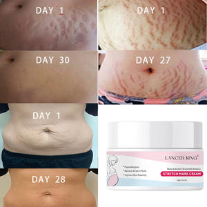 ملصقات مخصصة كريم طبيعي لعلامات التمدد للنساء الحوامل - Product Image 2