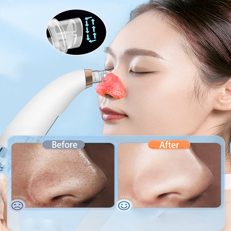 USB cable charging Blackhead Remover Machine Acne Suction Tool 155G
