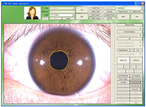 Máquina Analisadora De Saúde Câmeras Digitais Chinesas Máquina Analisadora De Saúde Analisador De Pele - Product Image 6