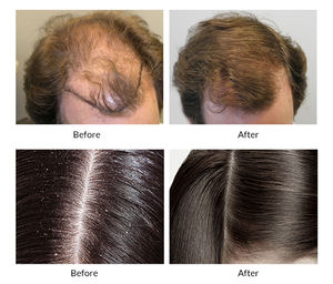 <span class=keywords><strong>แชมพู</strong></span><span class=keywords><strong>ญี่ปุ่น</strong></span>สำหรับผมร่วง ชุดแชมพูป้องกันผมร่วงเพื่อส่งเสริมการเจริญเติบโตของเส้นผม - Product Image 6