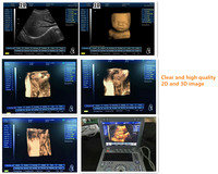 Untuk Mesin USG SUN-800D 3D/4D Human USG Ultrasound dengan Pencitraan 2D/3D Bebas Genggam, Spesialisasi Vaskular OB/GYN, Baterai Terpasang (3