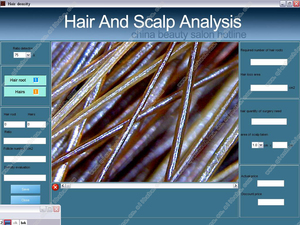 Precio de la máquina analizadora del cuero cabelludo del microscopio del folículo piloso <span class=keywords><strong>digital</strong></span> - Product Image 6
