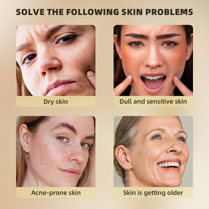 Essência de Cuidados com a Pele Natural de Marca Privada Reparação de Poros Iluminação Anti-Idade Hidratante Clareador Acne Sérum Facial com Própolis - Product Image 4